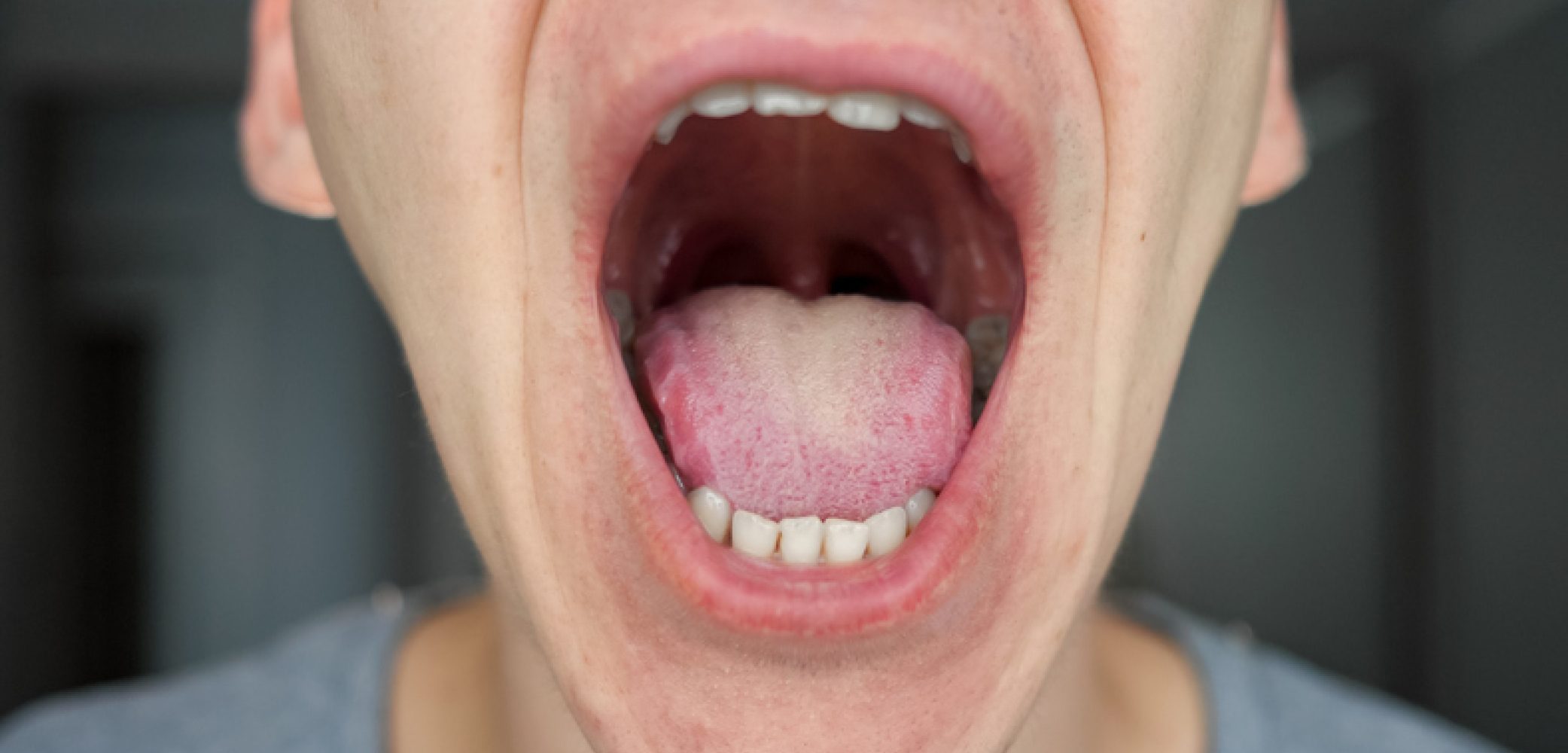 Picture of a person with their mouth wide open
